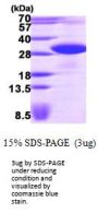 Human VAP-B Recombinant Protein