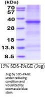 Human DcR3/TNFRSF6B Recombinant Protein