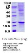 Human TIAF1 Recombinant Protein