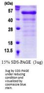 Human FGFR1OP Recombinant Protein
