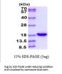 Human IL-33 Recombinant Protein