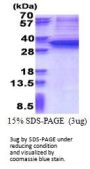 Human Snail Recombinant Protein