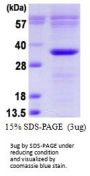 Human Bcl-10 Recombinant Protein