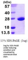e.coli sodA Recombinant Protein