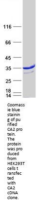 Carbonic Anhydrase II (CA2) (NM_000067) Human Recombinant Protein