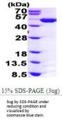 Human ASS1 Recombinant Protein