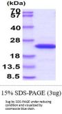 Human NRAS Recombinant Protein