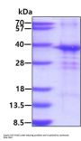 Human POMC Recombinant Protein