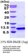 Human PTH Recombinant Protein