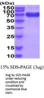 Human CD25/IL-2 R alpha Recombinant Protein