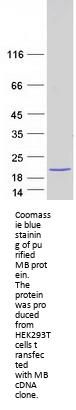 Myoglobin (MB) (NM_203378) Human Recombinant Protein