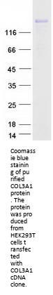 Collagen III (COL3A1) (NM_000090) Human Recombinant Protein
