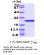 Human AlphaB Crystallin/CRYAB Recombinant Protein