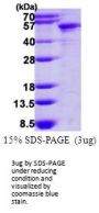 Human KRT14 Recombinant Protein