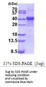 Human FGB Recombinant Protein
