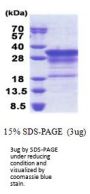 Human MBP Recombinant Protein
