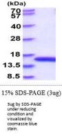 Rat FABP1/L-FABP Recombinant Protein