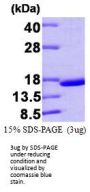 Human Transthyretin/Prealbumin Recombinant Protein