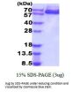 Human AFP Recombinant Protein
