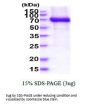Human TFRC Recombinant Protein