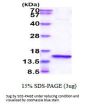 Human Angiogenin Recombinant Protein