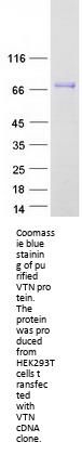 Vitronectin (VTN) (NM_000638) Human Recombinant Protein
