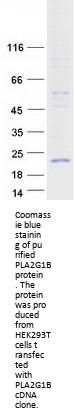 PLA2G1B (NM_000928) Human Recombinant Protein