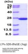 Human SOD2/Mn-SOD Recombinant Protein