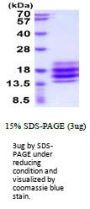 Human CD90/Thy1 Recombinant Protein
