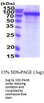 Human ErbB2/Her2 Recombinant Protein