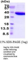 Rat Lactate Dehydrogenase A/LDHA Recombinant Protein