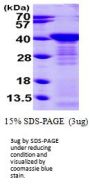Human Arginase 1/ARG1 Recombinant Protein