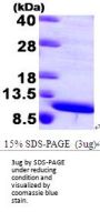 Human S100A8 Recombinant Protein