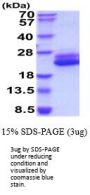 Human IL-6 Recombinant Protein