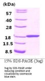 Human FABP3/H-FABP Recombinant Protein