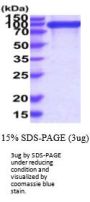 Human Integrin beta 1 Recombinant Protein