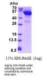 Human KRT8 Recombinant Protein