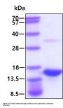 Human S100A9 Recombinant Protein