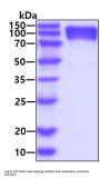 Human CEACAM-5/CD66e Recombinant Protein