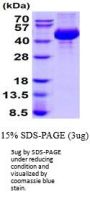 Mouse Cathepsin L Recombinant Protein