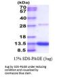 Mouse S100A4 Recombinant Protein