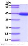 Human Lactate Dehydrogenase B/LDHB Recombinant Protein