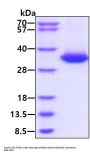 Human Kallikrein 3/PSA Recombinant Protein