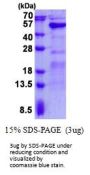 Human GALT Recombinant Protein