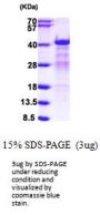 Human HNRNPC Recombinant Protein