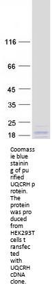 UQCRH (NM_006004) Human Recombinant Protein