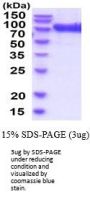 Human GUSB Recombinant Protein