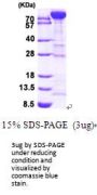 Human Muscle Phosphofructokinase/PFKM Recombinant Protein