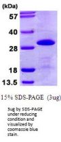 Human SNRPB2 Recombinant Protein
