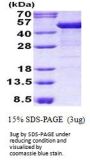 Human Cytokeratin 19 Recombinant Protein